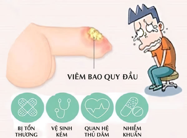 Chữa viêm bao quy đầu hiệu quả bằng cách nào?