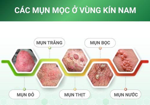 Dấu Hiệu Nổi Mụn Bất Thường Vùng Kín Nam